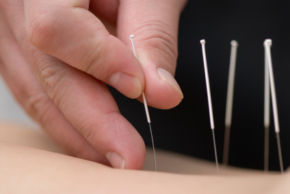 Acupuncture for Depression – Does it Work?